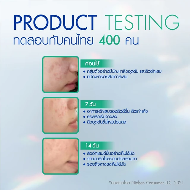 NIVEA MICELLAR ACNE ADVANCED 400ML